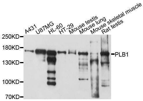Anti-PLB1 Antibody