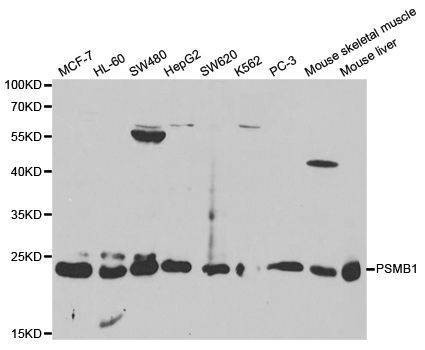 Anti-PSMB1 Antibody