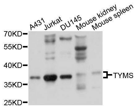 Anti-TYMS Antibody