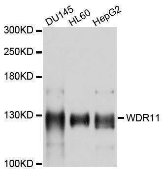 Anti-WDR11 Antibody