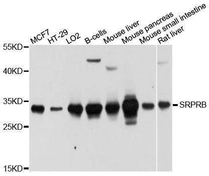 Anti-SRPRB Antibody