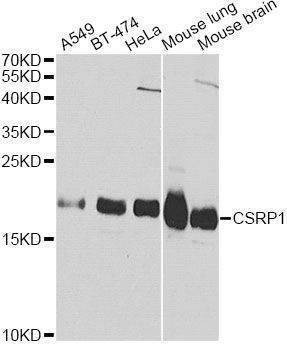 Anti-CSRP1 Antibody