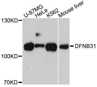 Anti-WHRN Antibody