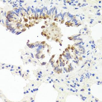 Anti-AMBRA1 Antibody