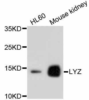 Anti-LYZ Antibody