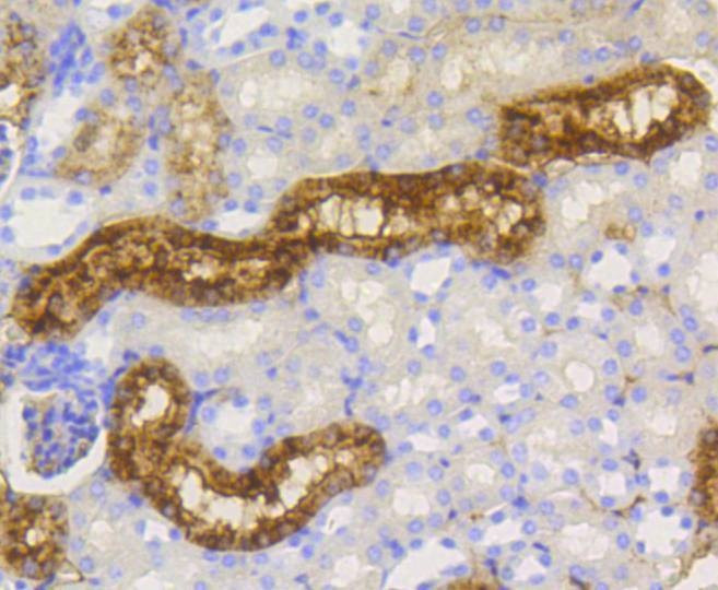 Anti-LYZ Antibody
