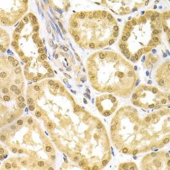 Anti-BAG1 Antibody