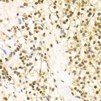 Anti-BAG1 Antibody