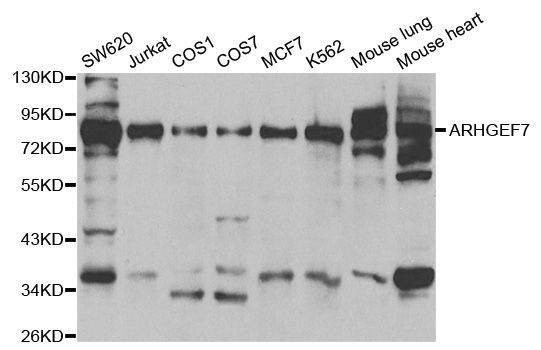 Anti-ARHGEF7 Antibody
