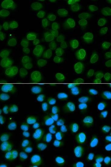 Anti-EMD Antibody