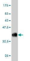 Anti-CABC1 Antibody