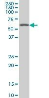 Anti-CABC1 Antibody