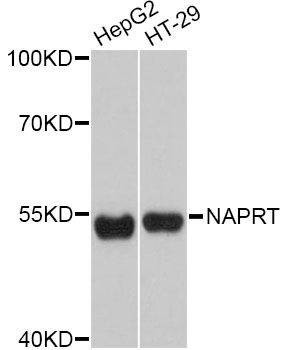 Anti-NAPRT Antibody
