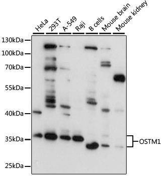 Anti-OSTM1 Antibody