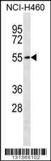 Anti-SLC16A3 (C-term) Antibody