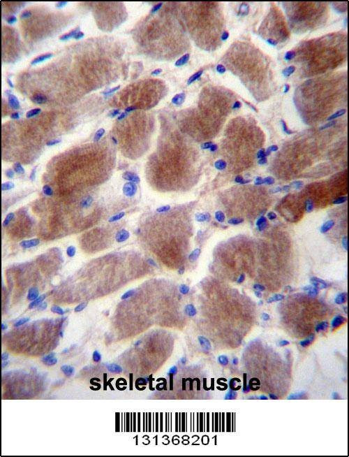 Anti-SLC16A3 (C-term) Antibody