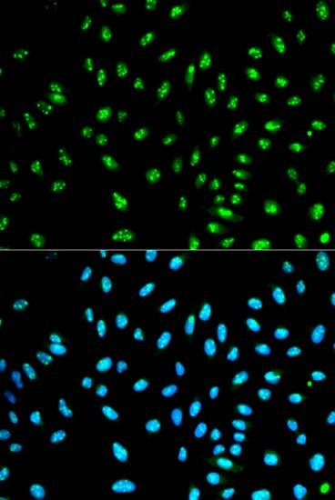 Anti-NCF2 Antibody