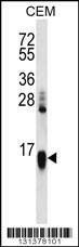 Anti-HIST1H2AA (N-term) Antibody