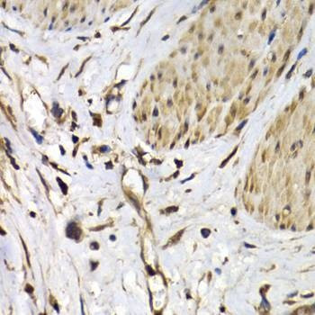 Anti-ISG15 Antibody