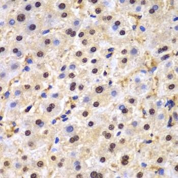 Anti-TARDBP Antibody