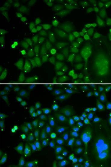 Anti-TARDBP Antibody