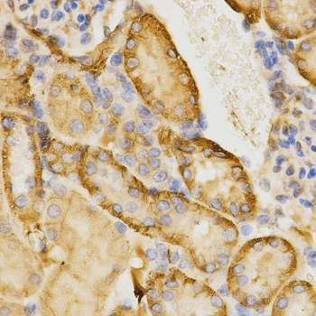 Anti-CDC42 Antibody