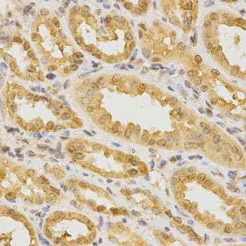 Anti-CDC42 Antibody