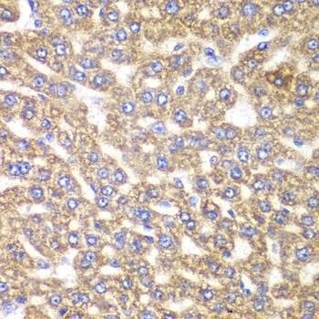 Anti-UGDH Antibody