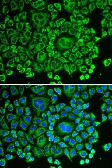 Anti-ARHGDIA Antibody