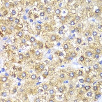 Anti-SHMT2 Antibody