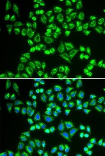 Anti-SHMT2 Antibody