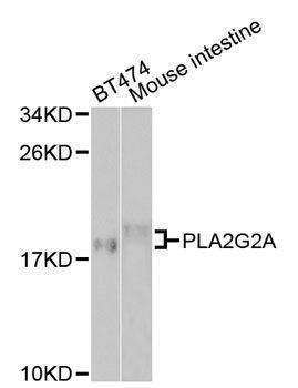 Anti-PLA2G2A Antibody