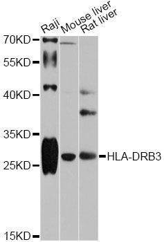 Anti-HLA-DRB3 Antibody