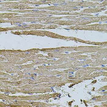 Anti-HMMR Antibody