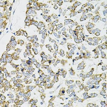Anti-PPP1CA Antibody