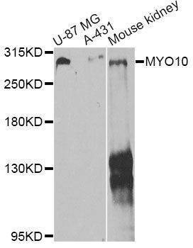 Anti-MYO10 Antibody