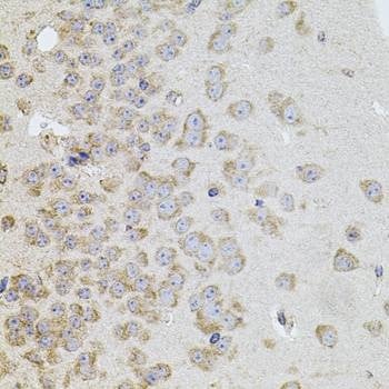 Anti-CLDN11 Antibody