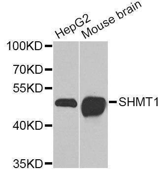 Anti-SHMT1 Antibody