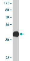 Anti-CACNA1C Antibody