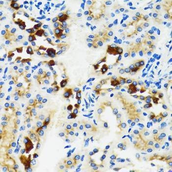 Anti-GABARAP Antibody