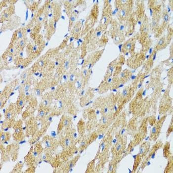 Anti-GABARAP Antibody