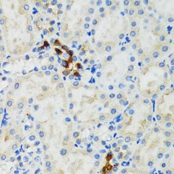 Anti-GABARAP Antibody
