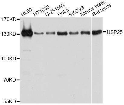 Anti-USP25 Antibody