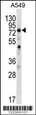 Anti-SPATA7 (C-term) Antibody