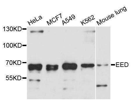 Anti-EED Antibody