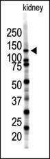 Anti-SENP7 (C-term) Antibody