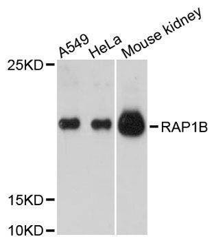 Anti-RAP1B Antibody