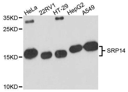 Anti-SRP14 Antibody