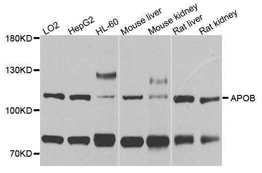 Anti-APOB Antibody