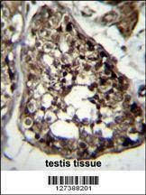 Anti-TBCEL (C-term) Antibody
